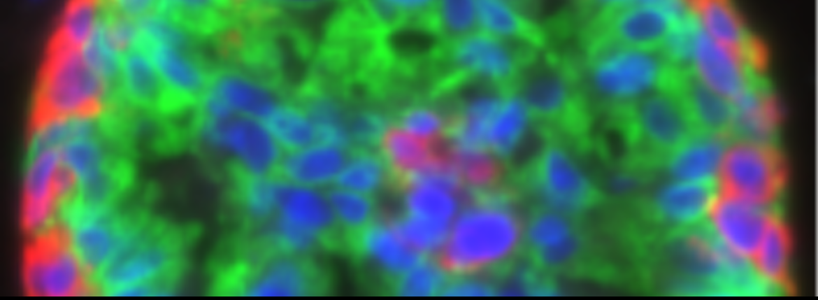 Microscopy immunofluorescent image of breast organoid