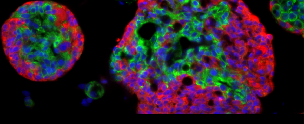 Microscopy immunofluorescent image of breast organoid